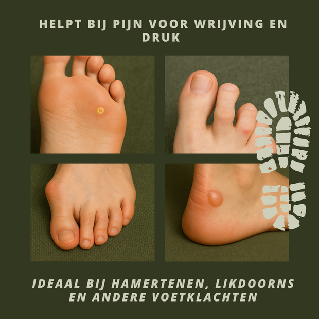 Voetenwol - Antidruk-wol 20 gram - 100% natuurlijke wol - Wandel wol voor voeten